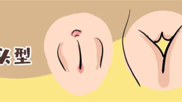 女生馒头型是什么意思