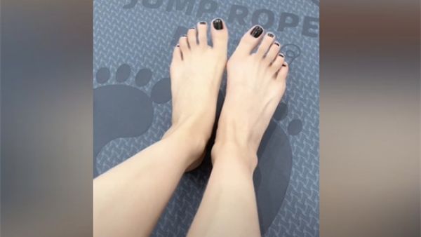 拇指外翻是什么意思