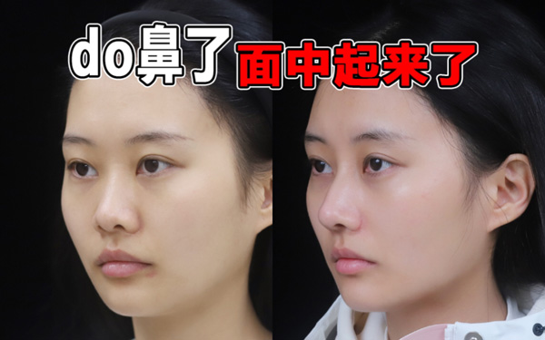do鼻子什么意思 - 第1张 - 坑多多 do鼻子什么意思 - 第1张